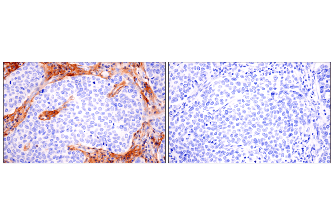 Immunohistochemistry Image 8: GLIPR2 (F7H7V) Rabbit mAb