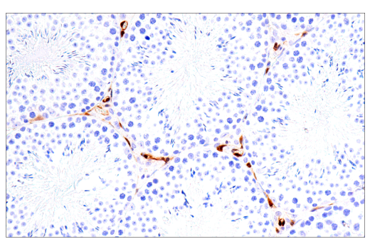 Immunohistochemistry Image 4: Galectin-3/LGALS3 (E7B6R) Rabbit mAb