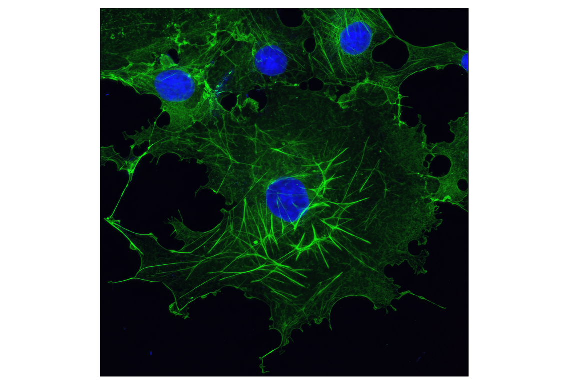 Immunofluorescence Image 1: β-Actin (13E5) Rabbit mAb