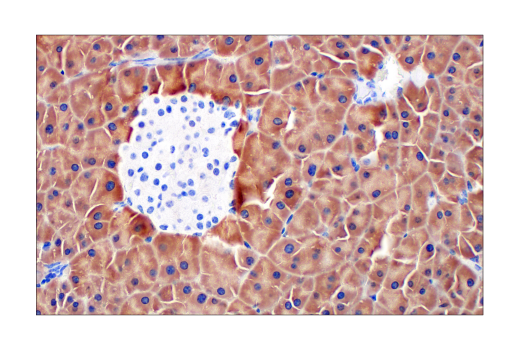 Immunohistochemistry Image 5: Asparagine Synthetase (E6C2C) XP<sup>®</sup> Rabbit mAb (BSA and Azide Free)