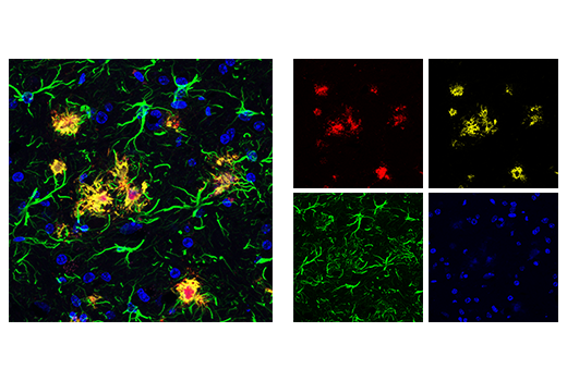 Immunofluorescence Image 1: β-Amyloid (1-43) (E8C2D) Rabbit mAb (Alexa Fluor<sup>®</sup> 555 Conjugate)