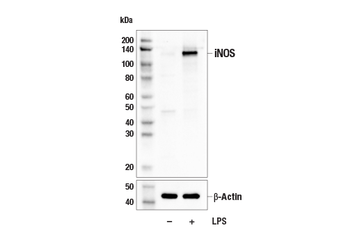 Western Blotting Image 1: iNOS (E1W4J) Rabbit mAb