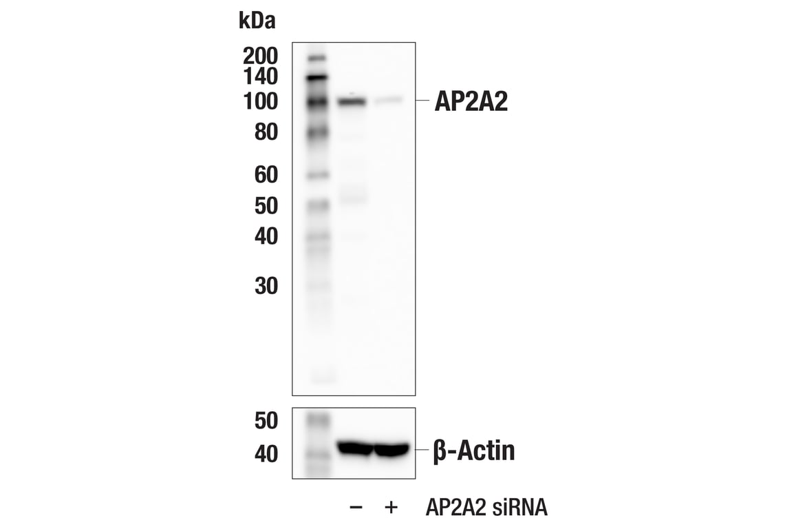 Western Blotting Image 3: AP2A2 (E9Q1O) Rabbit mAb