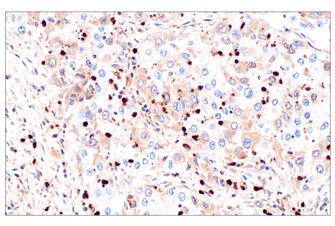 Immunohistochemistry Image 3: Catalase (D4P7B) XP<sup>®</sup> Rabbit mAb