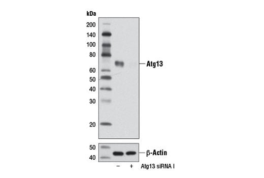 undefined Image 1: SignalSilence<sup>®</sup> Atg13 siRNA I