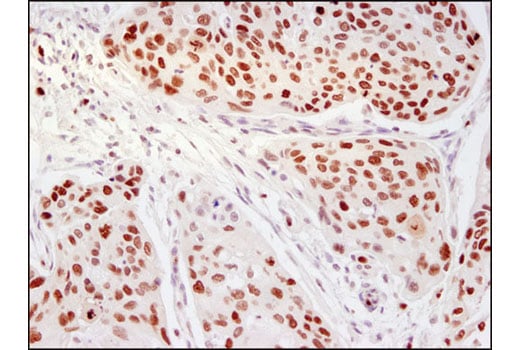 Immunohistochemistry Image 2: Ezh2 (D2C9) XP<sup>®</sup> Rabbit mAb (BSA and Azide Free)