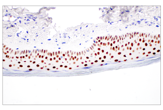 Immunohistochemistry Image 5: POU2F3 (E5N2D) XP<sup>®</sup> Rabbit mAb