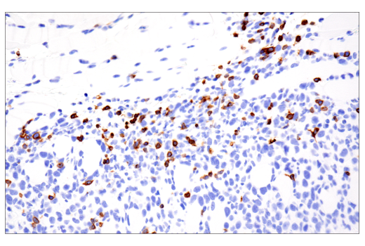 Immunohistochemistry Image 2: CD3ε (E4T1B) XP<sup>®</sup> Rabbit mAb (BSA and Azide Free)