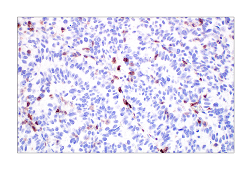 undefined Image 41: Human Exhausted CD8<sup>+</sup> T Cell IHC Antibody Sampler Kit