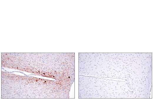 Immunohistochemistry Image 1: Tyrosine Hydroxylase (E2L6M) Rabbit mAb (BSA and Azide Free)