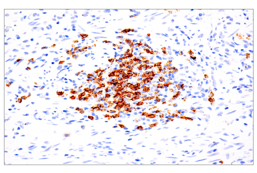 Immunohistochemistry Image 4: CD20 (L26) Mouse mAb