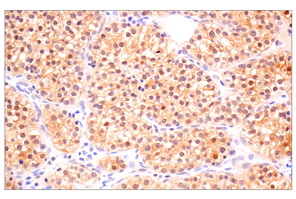 Immunohistochemistry Image 1: ACBP/DBI (E6K8G) XP<sup>®</sup> Rabbit mAb