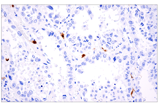 Immunohistochemistry Image 5: Calretinin (E7R6O) XP<sup>®</sup> Rabbit mAb