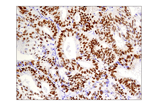 Immunohistochemistry Image 8: Phospho-ATF-2 (Thr71)/ATF-7 (Thr53) (E4A5G) XP<sup>®</sup> Rabbit mAb