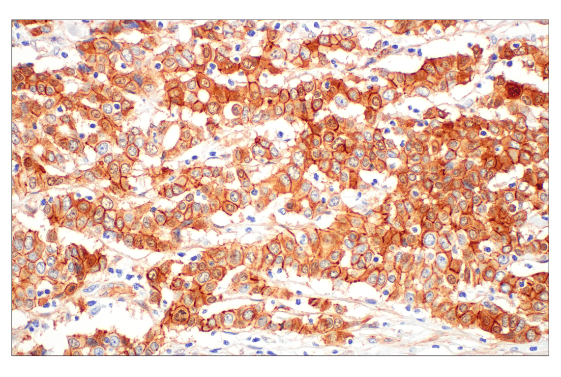 undefined Image 30: Cadherin-Catenin Antibody Sampler Kit