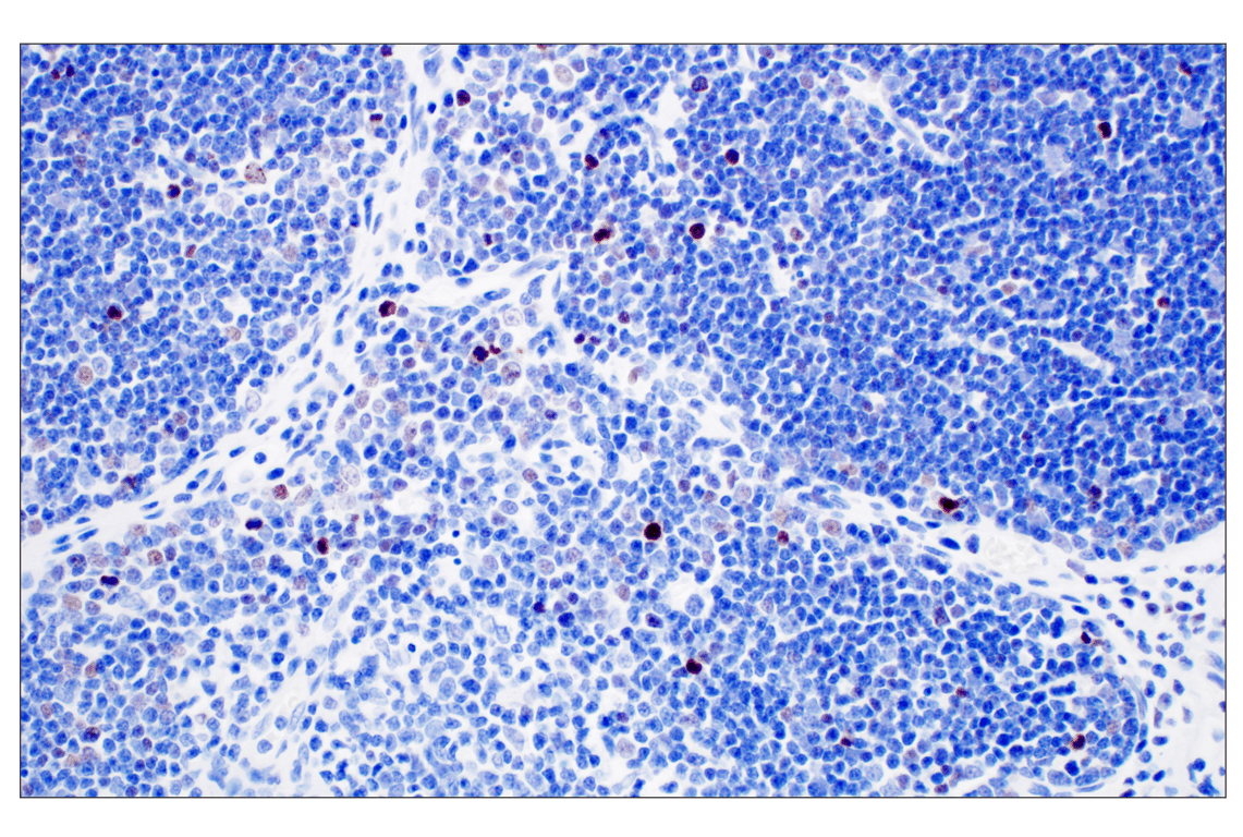 Immunohistochemistry Image 5: Phospho-Histone H3 (Ser10) (D7N8E) XP<sup>®</sup> Rabbit mAb (BSA and Azide Free)
