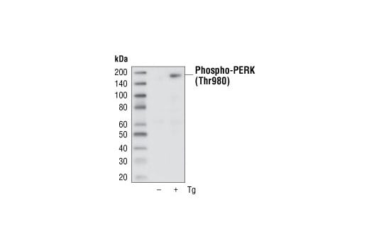 Western Blotting Image 1: Phospho-PERK (Thr980) (16F8) Rabbit mAb