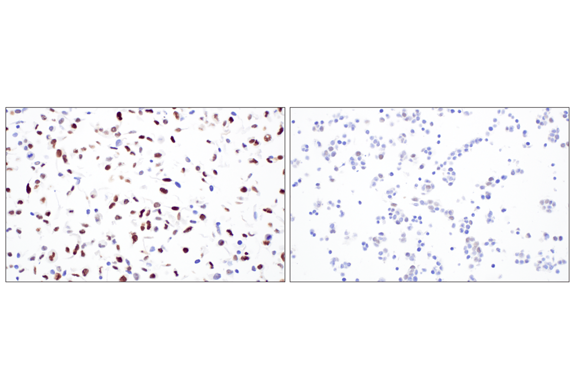 Immunohistochemistry Image 8: MASTL (F7I2C) Rabbit mAb