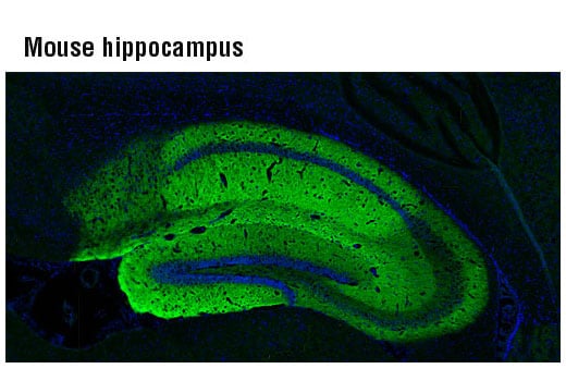 Immunofluorescence Image 1: AMPA Receptor 1 (GluA1) (D4N9V) Rabbit mAb (BSA and Azide Free)