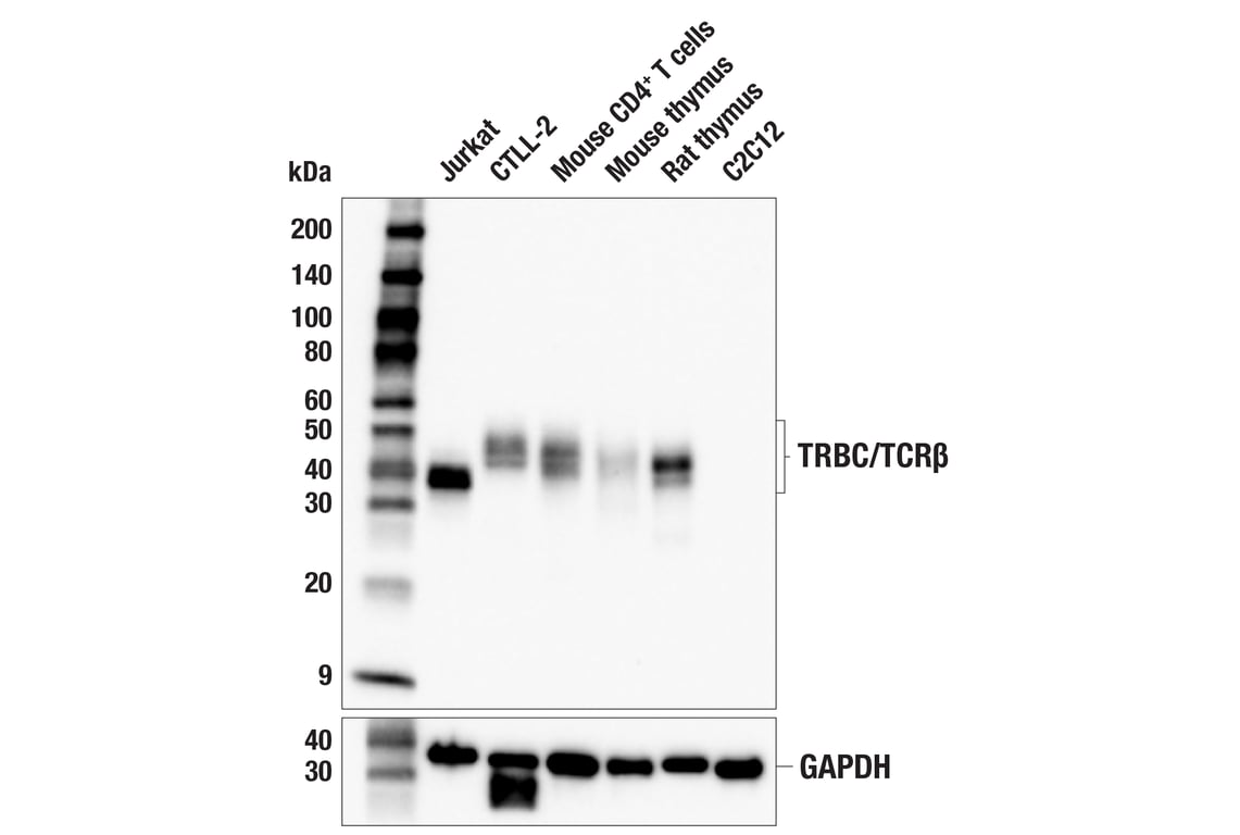 Western Blotting Image 2: TRBC/TCRβ (E9I1S) Rabbit mAb