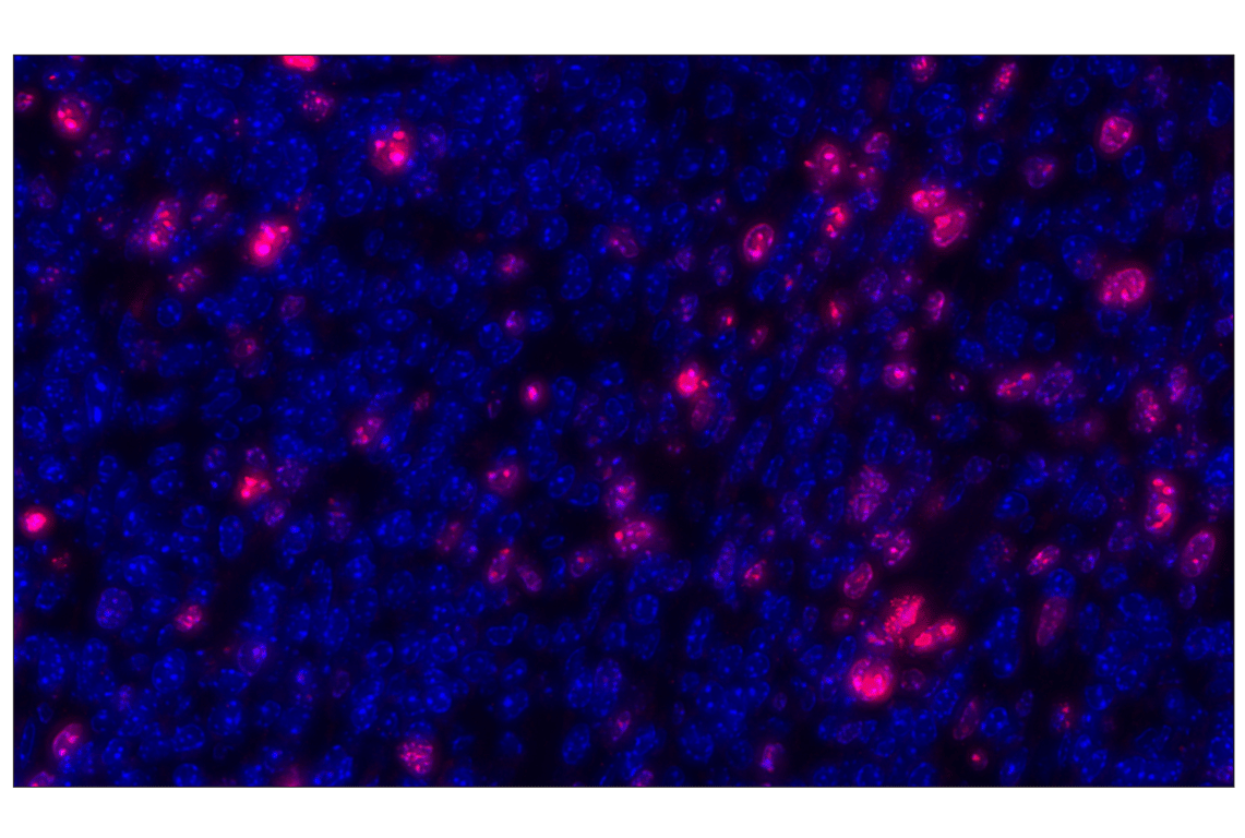 Ki-67 (D3B5) Rabbit mAb (Alexa Fluor® 647 Conjugate) | Cell Signaling ...