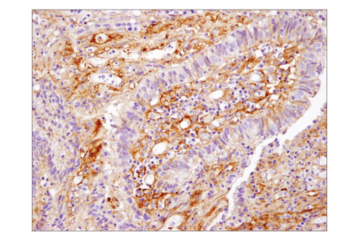 Immunohistochemistry Image 1: B7-H3 (D9M2L) XP<sup>®</sup> Rabbit mAb (BSA and Azide Free)