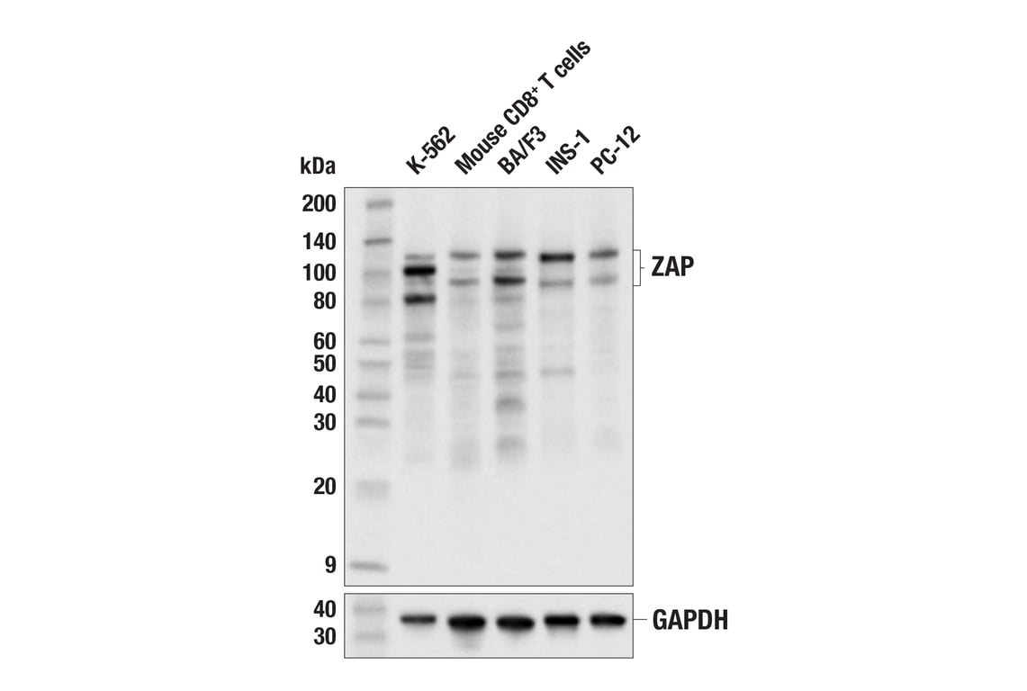 Western Blotting Image 2: ZAP (E5V4D) Rabbit mAb