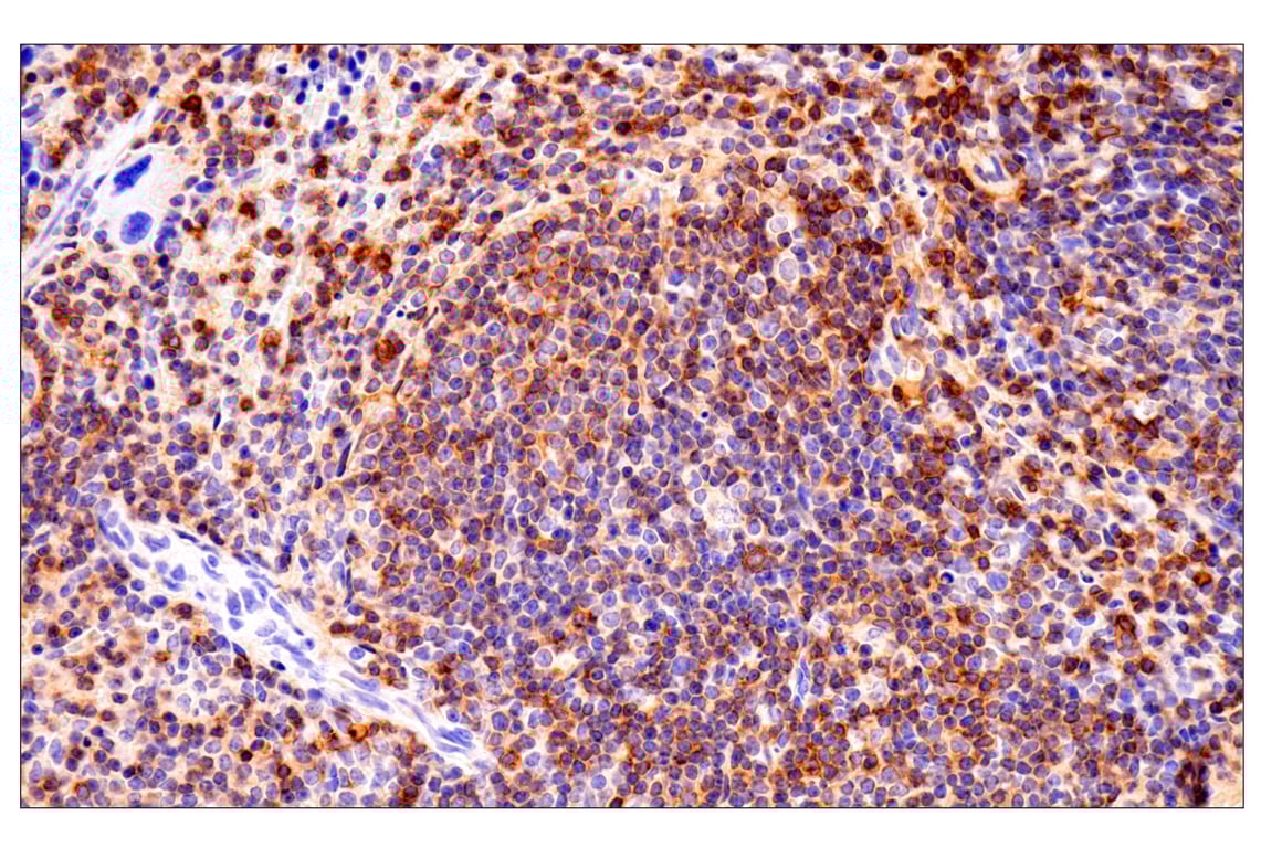 Immunohistochemistry Image 5: CD62L/L-Selectin (E7L2M) Rabbit mAb