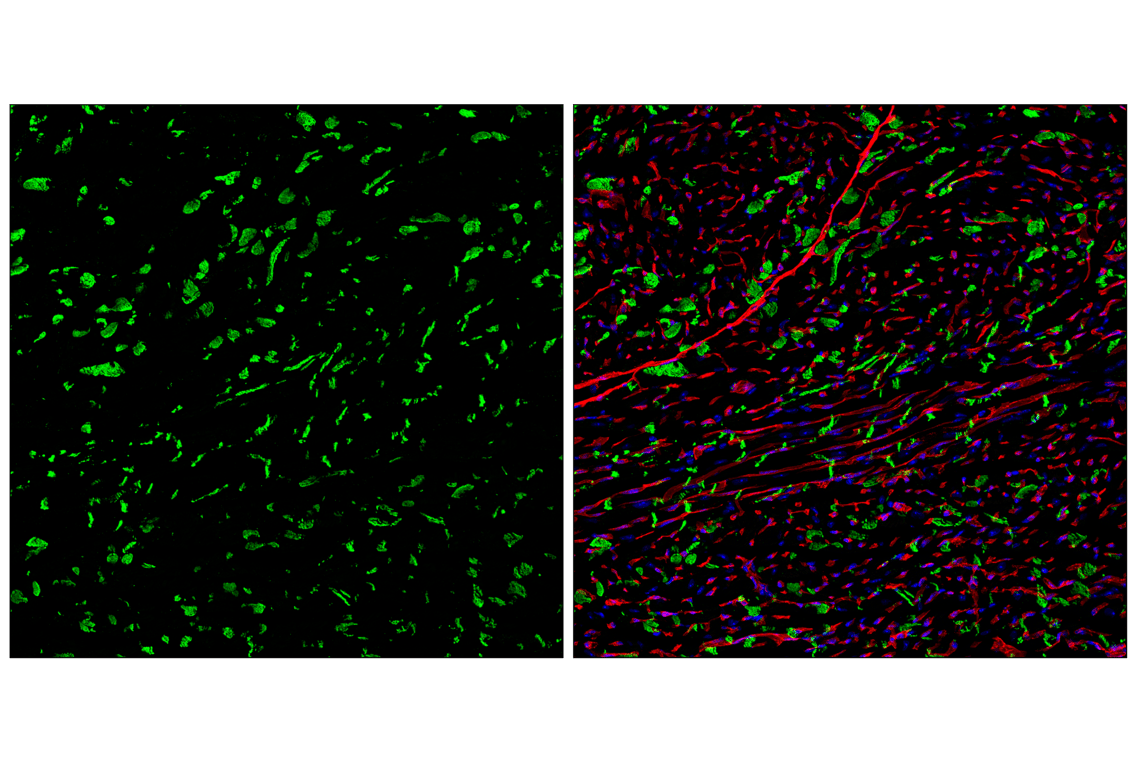 Immunofluorescence Image 2: N-Cadherin (D4R1H) XP<sup>®</sup> Rabbit mAb (Alexa Fluor<sup>®</sup> 488 Conjugate)