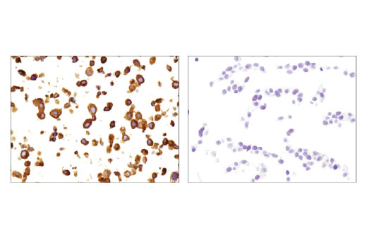 Immunohistochemistry Image 4: Ret (E1N8X) XP<sup>®</sup> Rabbit mAb