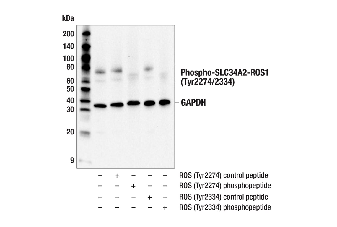 Western Blotting Image 3: Phospho-ROS1 (Tyr2274/2334) (E8F5J) Rabbit mAb