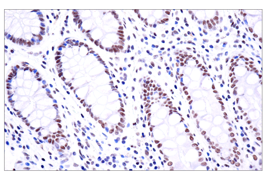 undefined Image 42: BAF Complex IHC Antibody Sampler Kit