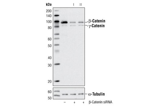 undefined Image 2: SignalSilence<sup>®</sup> β-Catenin siRNA I