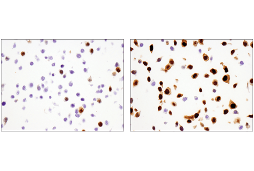 Immunohistochemistry Image 5: PAF15 (D8E2Y) XP<sup>®</sup> Rabbit mAb