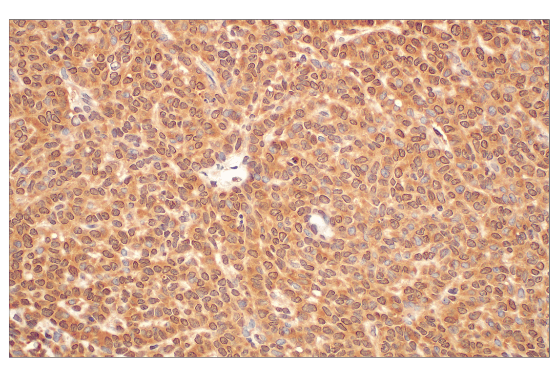 Immunohistochemistry Image 5: MTAP (E5R1I) Rabbit mAb (BSA and Azide Free)