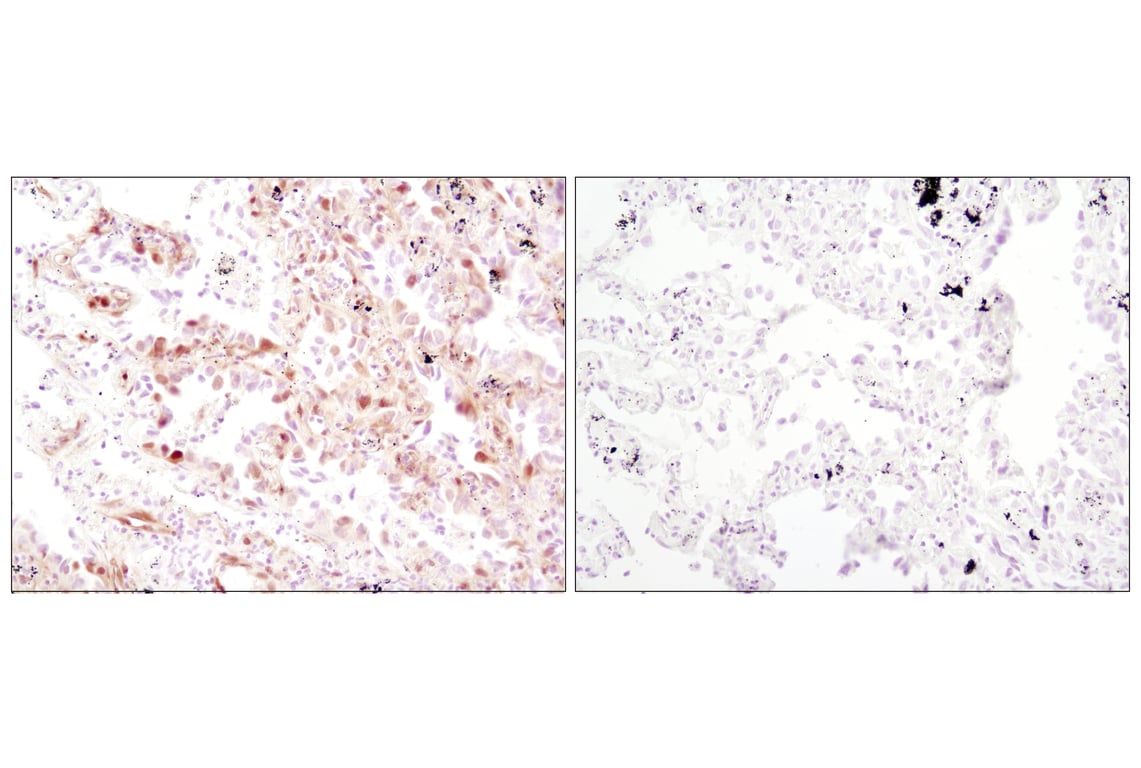 Immunohistochemistry Image 2: Phospho-p44/42 MAPK (Erk1/2) (Thr202/Tyr204) (D13.14.4E) XP<sup>®</sup> Rabbit mAb