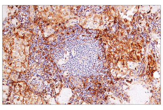 Immunohistochemistry Image 2: CD141/Thrombomodulin (E7Y9P) XP<sup>®</sup> Rabbit mAb (BSA and Azide Free)