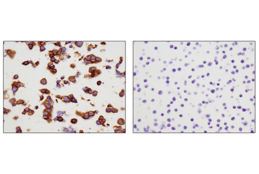 Immunohistochemistry Image 1: c-Kit (D3W6Y) XP<sup>®</sup> Rabbit mAb