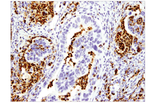 Immunohistochemistry Image 1: Myeloperoxidase (E1E7I) XP<sup>®</sup> Rabbit mAb