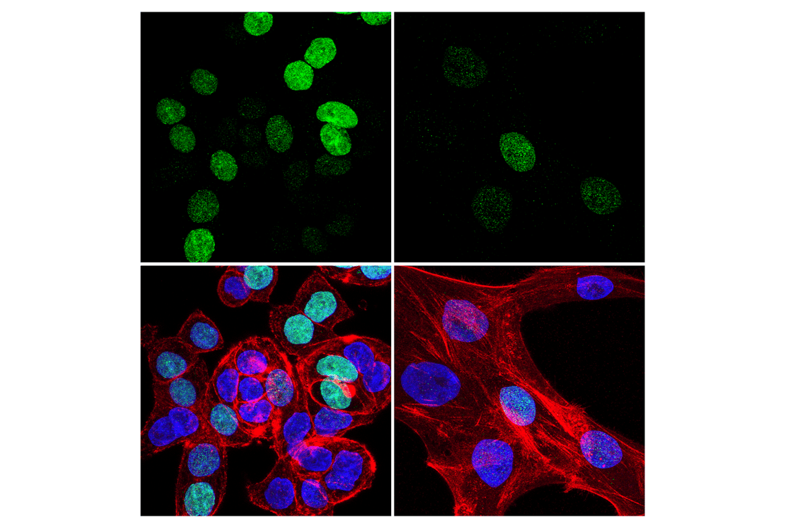 Immunofluorescence Image 1: ATAD2 (E8Y7F) Rabbit mAb