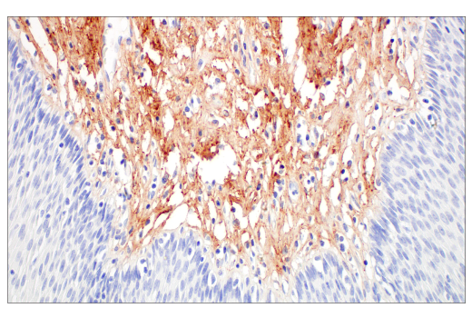 Immunohistochemistry Image 8: COL14A1 (E5W8S) Rabbit mAb (BSA and Azide Free)