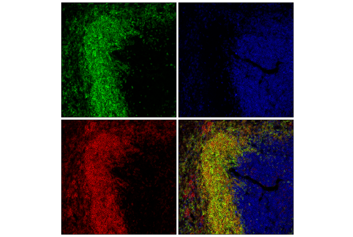 Immunofluorescence Image 2: CD22 (F9D1W) Rabbit mAb (BSA and Azide Free)