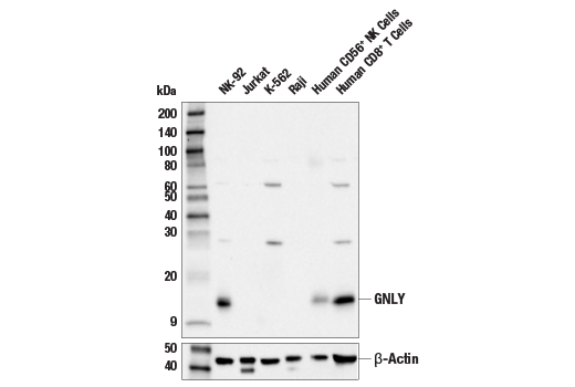 Western Blotting Image 1: GNLY (E1V5M) Rabbit mAb (BSA and Azide Free)