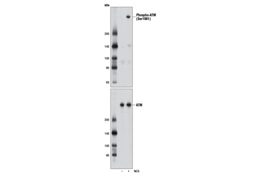 undefined Image 1: PhosphoPlus<sup>®</sup> ATM (Ser1981) Antibody Duet