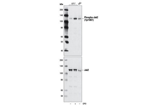 undefined Image 4: Stat3/Stat5 Signaling Antibody Sampler Kit