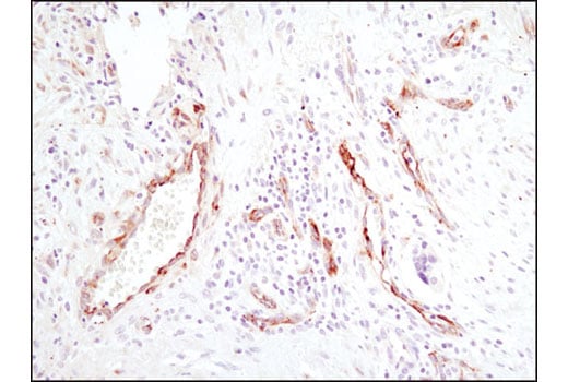 undefined Image 30: Extracellular Matrix Dynamics Antibody Sampler Kit