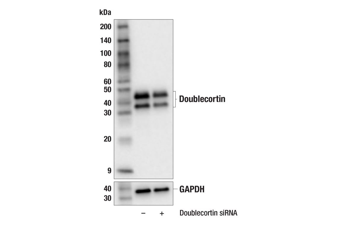 Western Blotting Image 2: Doublecortin (F6K9E) Rabbit mAb (BSA and Azide Free)