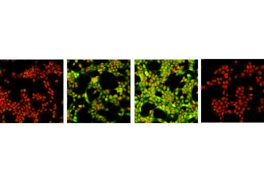 undefined Image 16: 4E-BP Antibody Sampler Kit