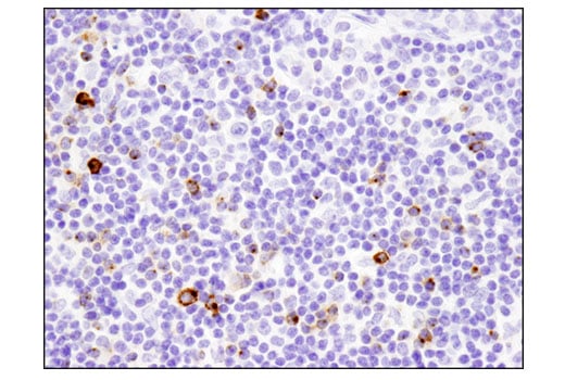 undefined Image 42: Human Exhausted CD8<sup>+</sup> T Cell IHC Antibody Sampler Kit