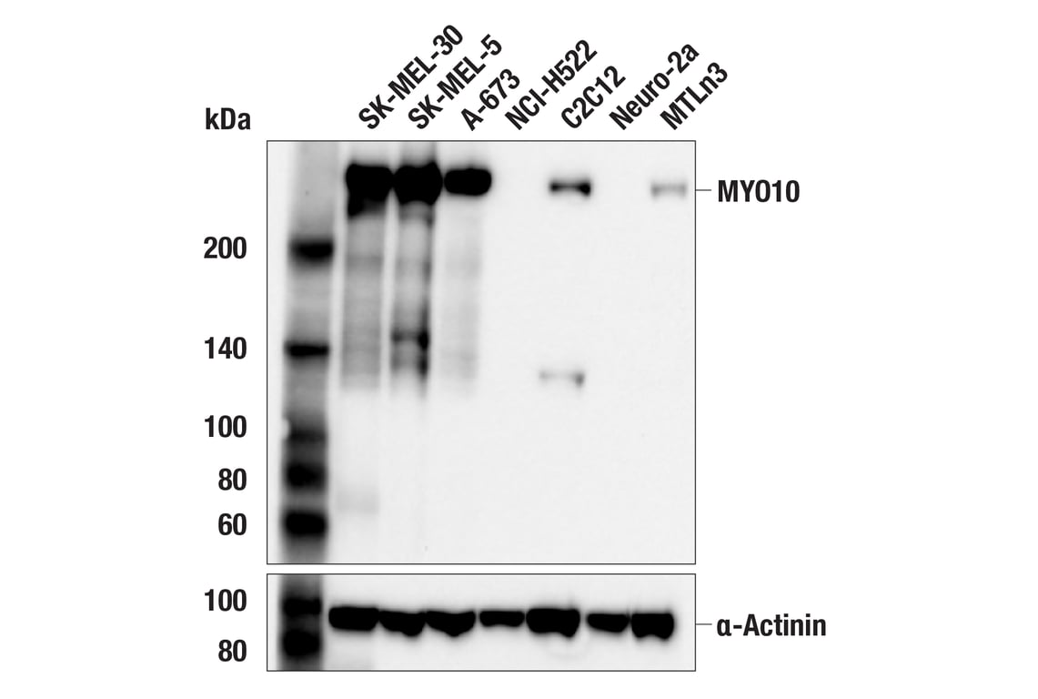 Western Blotting Image 1: MYO10 (F3V7U) Rabbit mAb